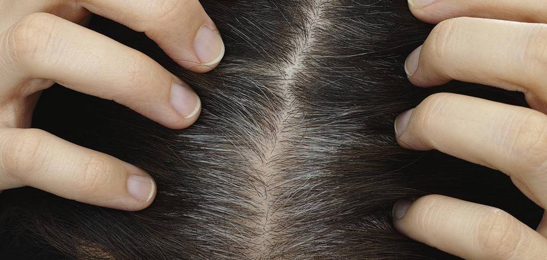 3 главные причины, провоцирующие ранее появление седых волос
