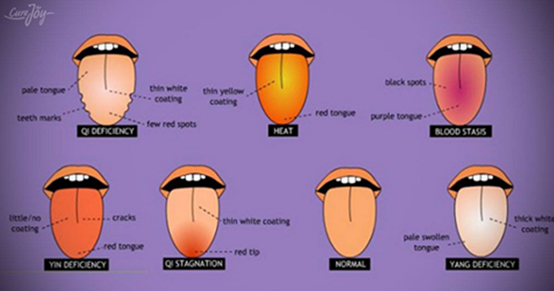 Виды цвета языка. Заболевания по цвету языка.