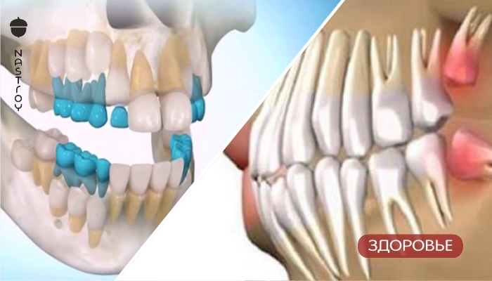 Попрощайтесь с зубными имплантатами, Вы можете вырастить собственные зубы за 9 недель! 