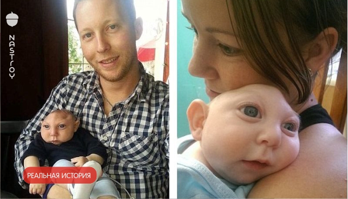 Этот малыш родился без мозга. 3 года спустя врачи не поверили своим глазам, когда увидели снимки
