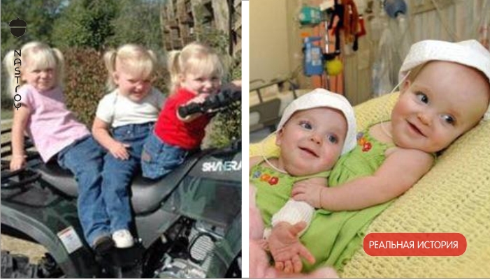 От этих тройняшек отказались родители. Вот, что случилось с сиамскими близнецами и их сестричкой спустя 14 лет.