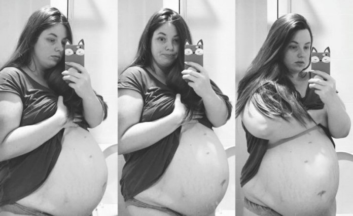 Беременная в 4 й раз женщина понимала, что такого с ее животом быть не должно