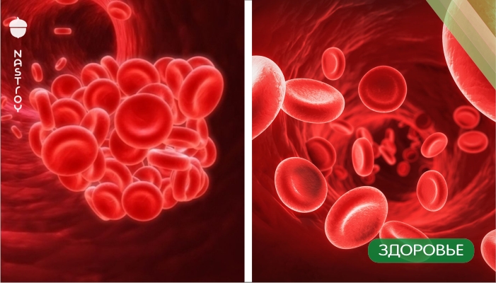Как разжижать кровь в организме: рецепты домашних снадобий от кислородного голодания тканей  