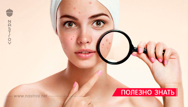 Кислотная польза: 7 видов кислоты, которые сделают кожу идеальной!