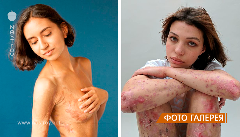 Фотопроект: люди показывают свои шрамы и рассказывают о том, как их получили!