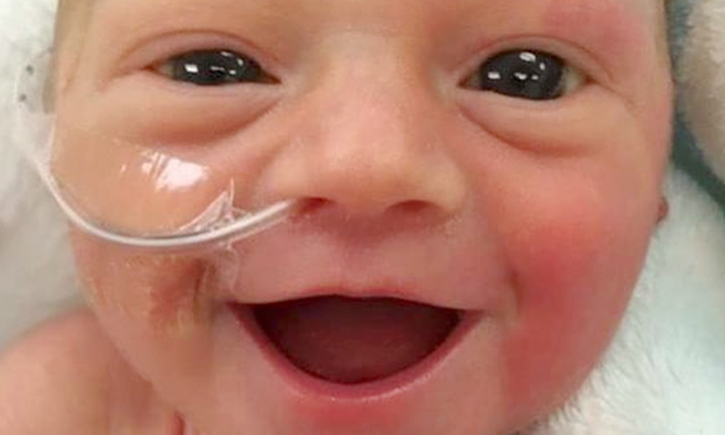 Недоношенная малышка улыбается от уха до уха через 5 дней после рождения!