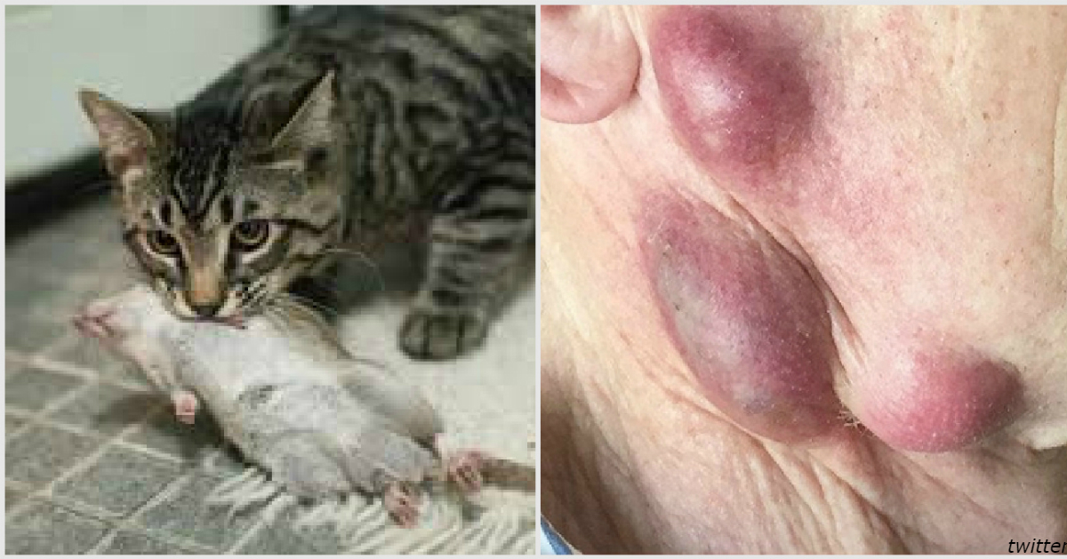 68 летний мужчина заболел опасной для жизни инфекцией. Заразился от кота!