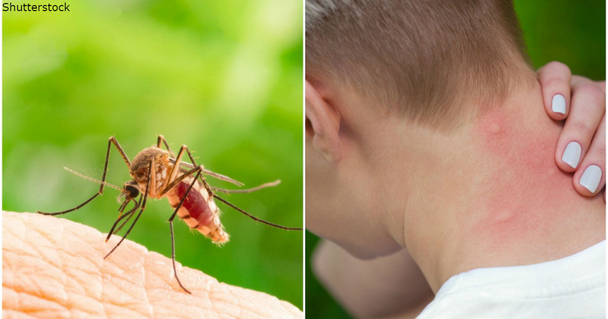 Как кусают комары