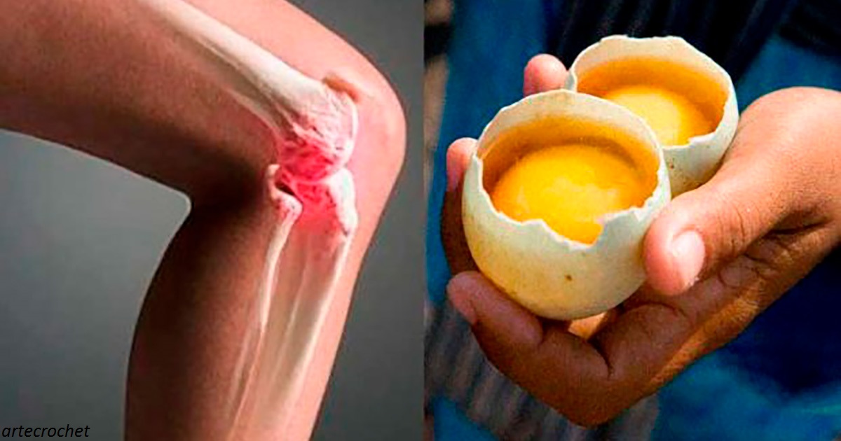 Вот как 2 яйца могут помочь вам избавиться от боли в коленях   и частично исцелить суставы