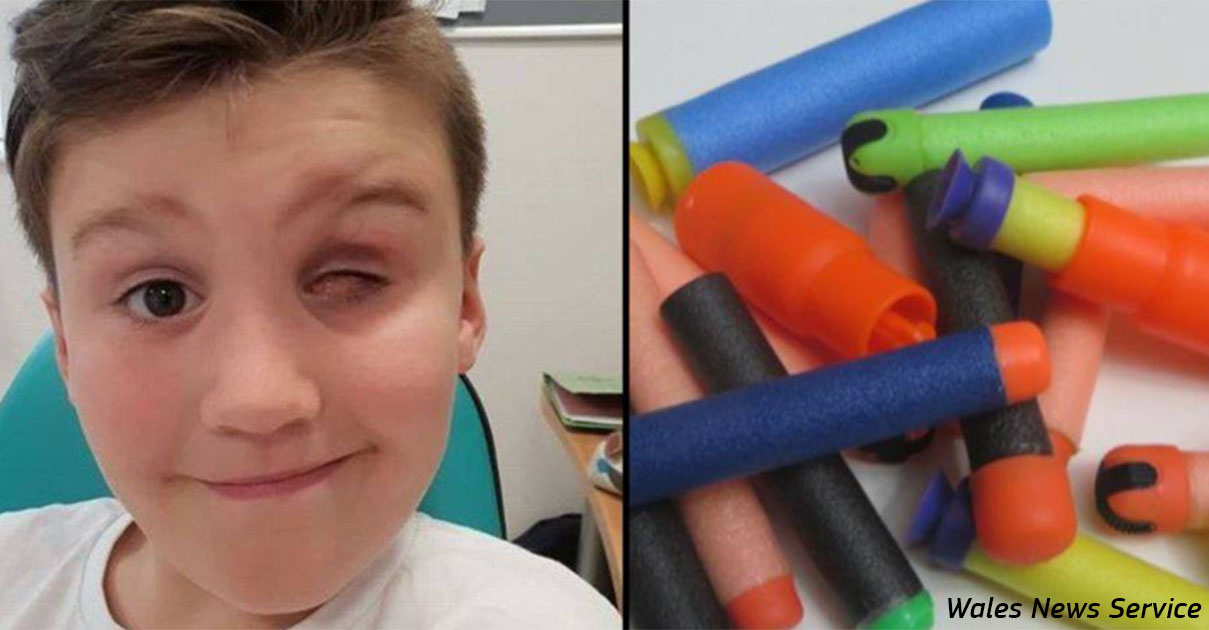 9 летний мальчик лишился глаза из за игрушки, которую сейчас хотят все дети