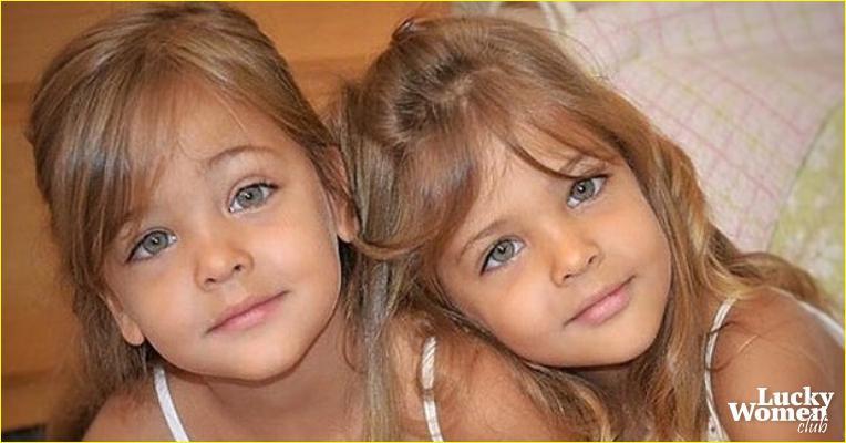 В 7 лет их назвали самыми красивыми близнецами в мире. Вот как они выглядят сейчас