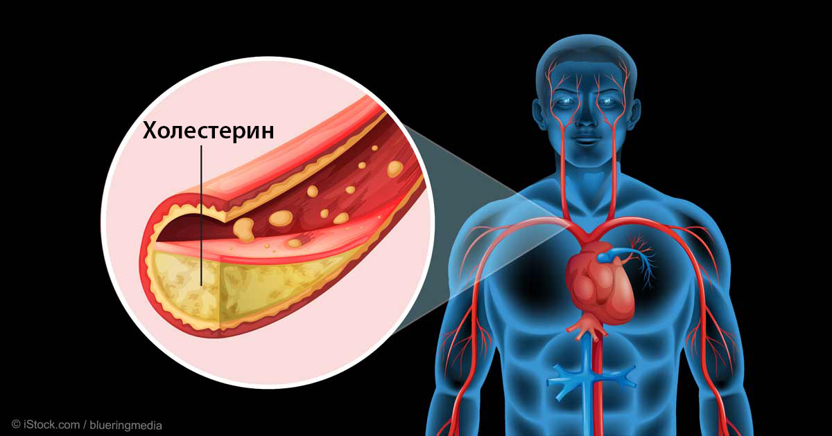 Вот как вычистить сосуды от холестерина за 40 дней без единого лекарства