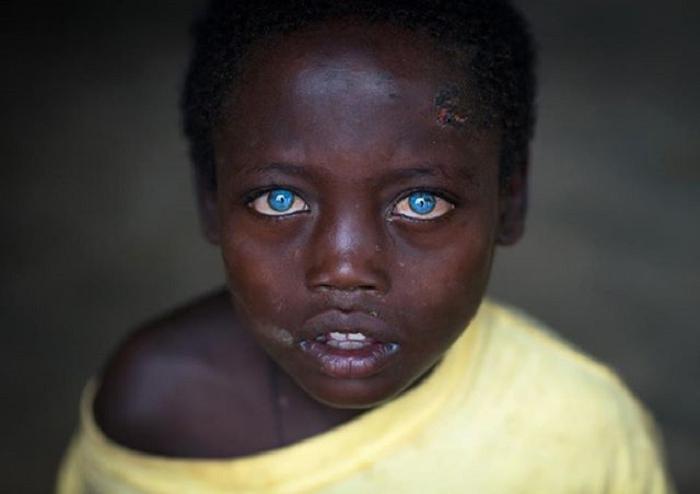 Темнокожий мальчик из Эфиопии уже сейчас очаровывает всех необычно яркими голубыми глазами