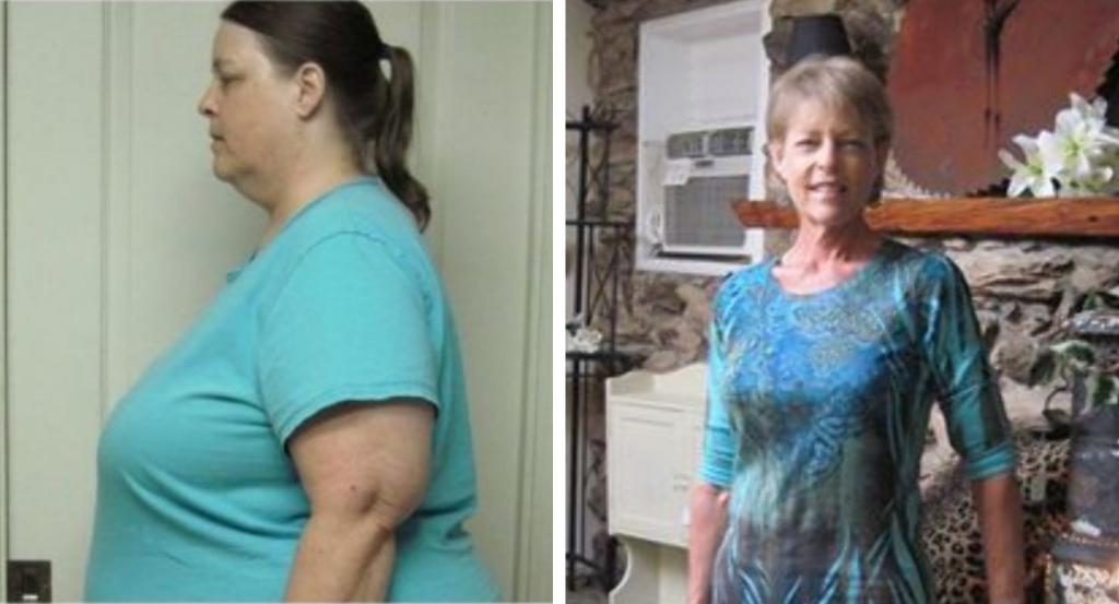 Женщина в свои 63 года сбросила 102 кг и поделилась секретом успеха