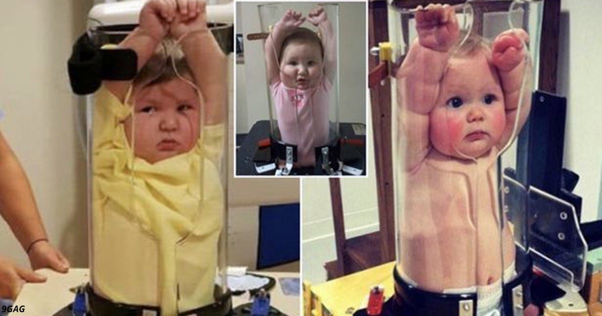 Интернет насмешили фото детей в медицинском чудо устройстве для рентгена