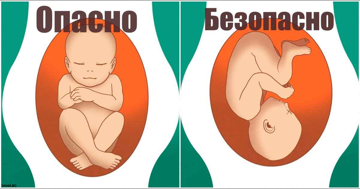 Вот что означают разные позы ребенка во время беременности