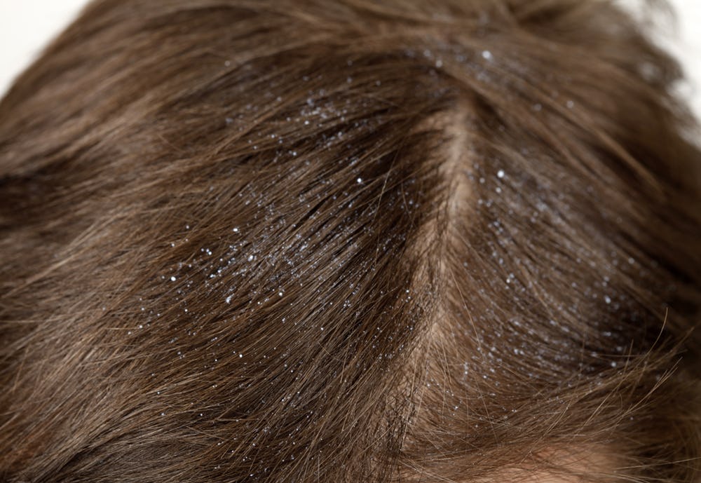 Как избавиться от торчащих волос на голове в домашних условиях