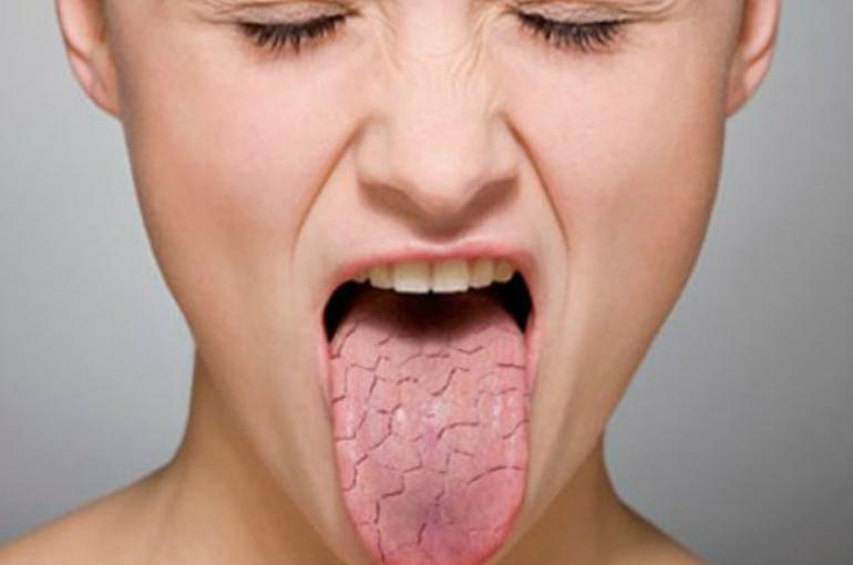 Необычные причины запаха изо рта и простые способы решения проблемы