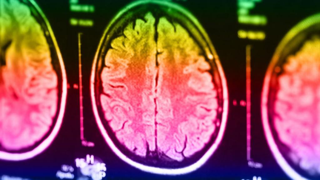 Склонность к преступлениям можно будет определять с помощью сканирования мозга: новые исследования