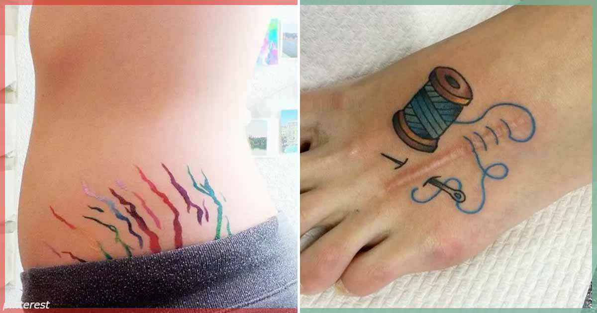 20 шрамов, которые были превращены в шикарные татуировки