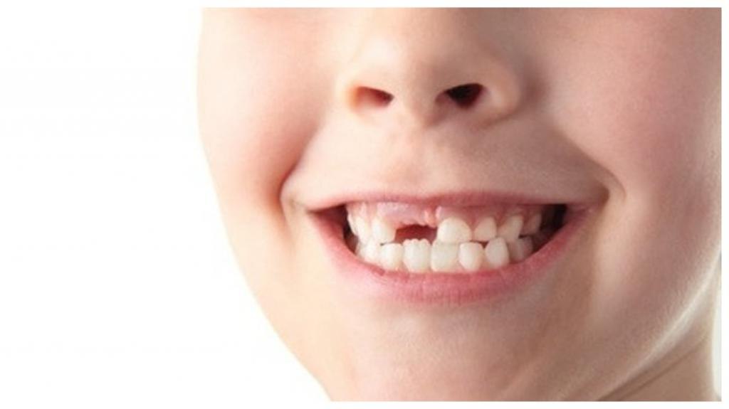 Что делают стоматологи с нашими удаленными зубами: они нам об этом не расскажут