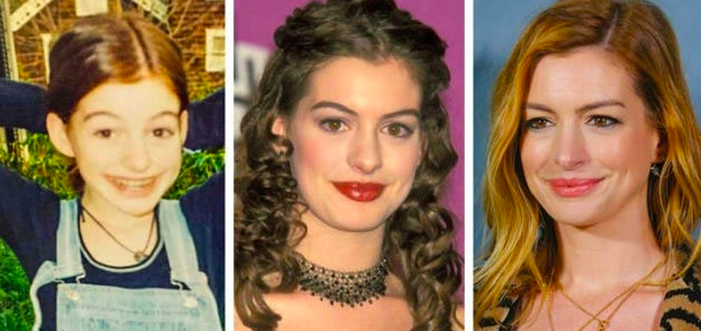 Вот как знаменитые голливудские актрисы изменились с детства
