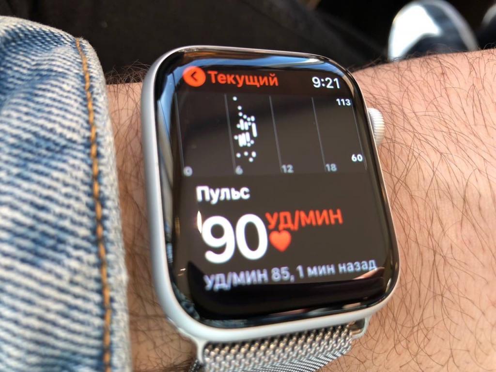 Умные, да не очень: кардиологи раскритиковали функцию ЭКГ в Apple Watch 4