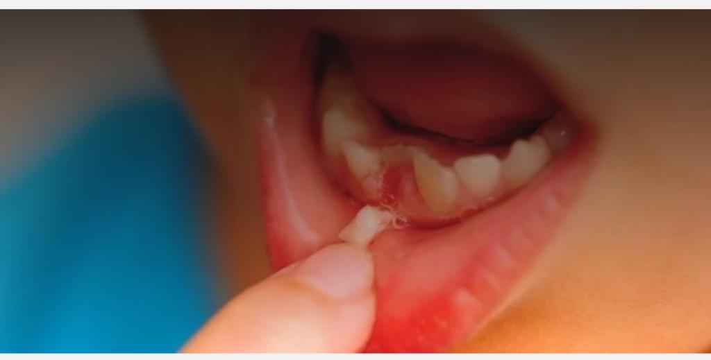 Не спешите отдавать молочные зубы Зубной Фее или Мышонку, что живет за печкой. Есть более полезная альтернатива