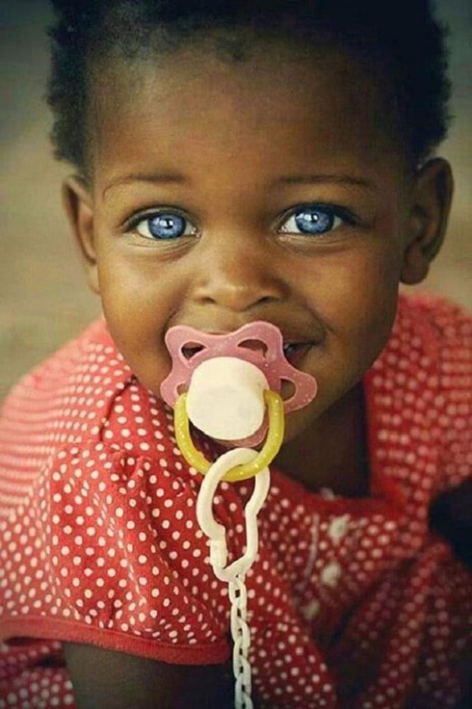 Редчайшее чудо природы: как выглядят темнокожие дети, рожденные с голубыми глазами