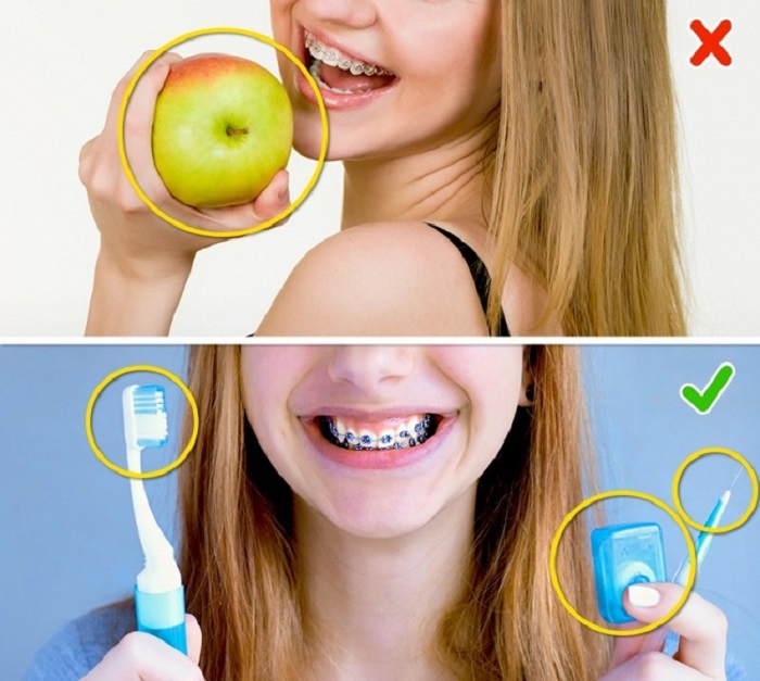 8 основных ошибок во время чистки зубов: оказывается, на щетку нужно наносить совсем чуть-чуть пасты