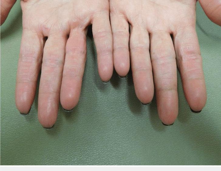 Повод посмотреть на свои руки с большим вниманием: 10 фактов об отпечатках пальцев