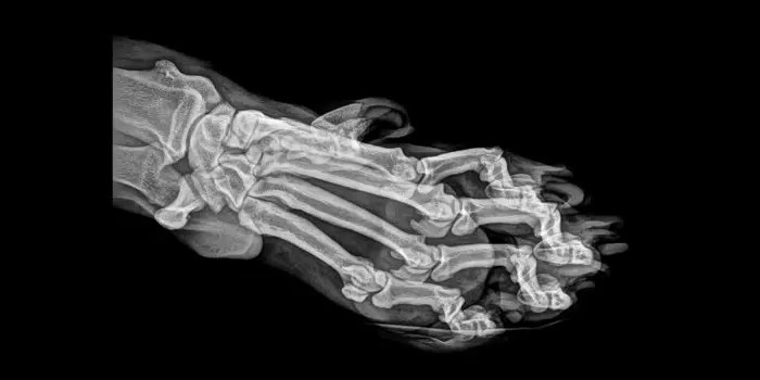 Большой волосатый броненосец и другие обитатели Лондонского зоопарка на рентгеновских снимках