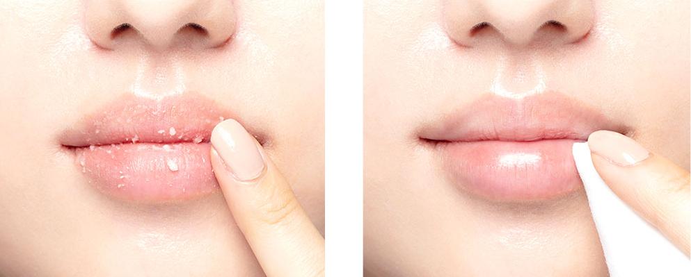 Пилинг, бальзам и исключение стойких помад: косметолог рассказал, как ухаживать за губами, чтобы они не обветривались