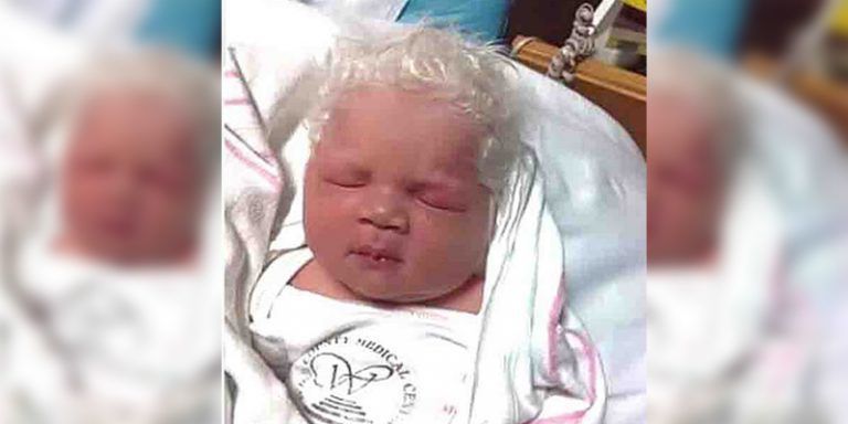 В Венгрии родился необычный малыш: особенностью является то, что от рождения у него седые волосы