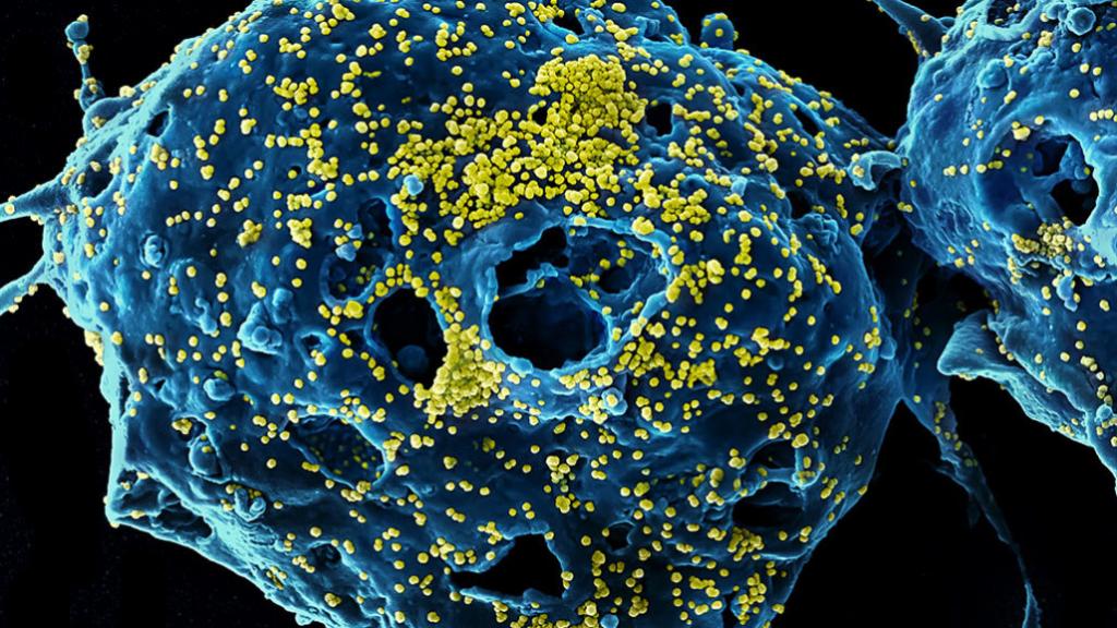 Что мы знаем о новом китайском вирусе, прививки от которого нет, и ждет ли Россию эпидемия?