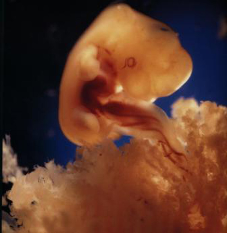 Фото эмбриона на 6 неделе