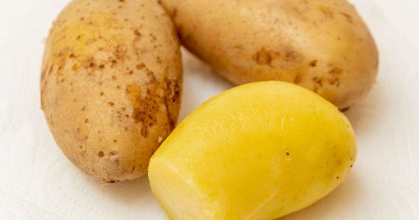 В кожуре картошки больше калия, чем в бананах: врач делится рецептом полезного приготовления овоща