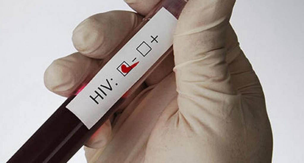 Бразильские ученые сообщили о третьем случае выздоровления от ВИЧ инфекции