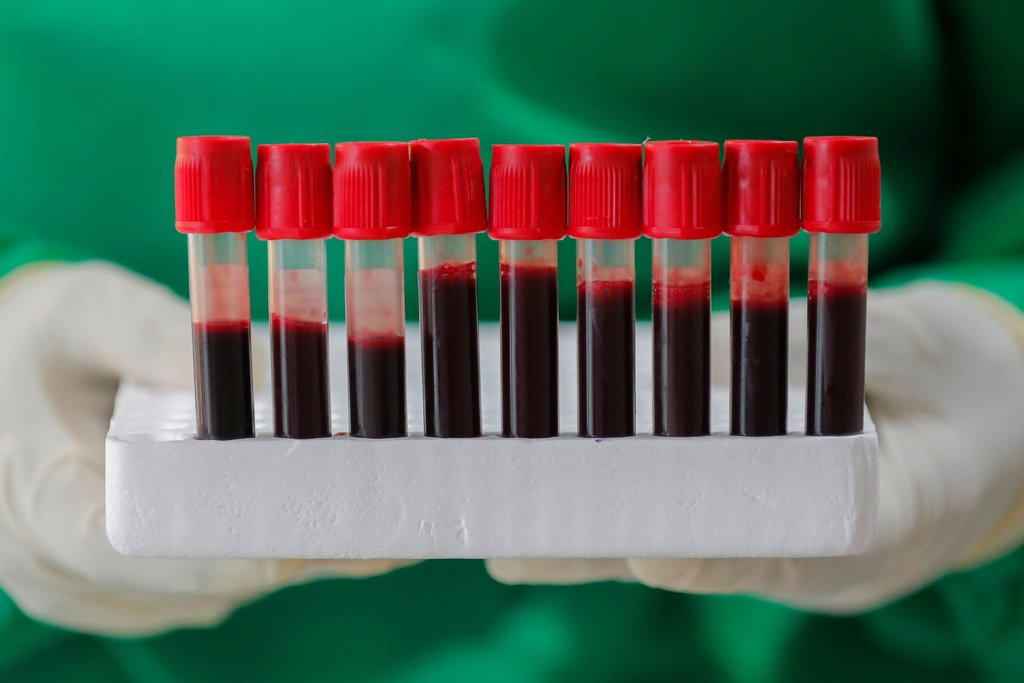 Люди со II группой крови не подвергаются большему риску заболеть КОВИД 19, показали новые исследования