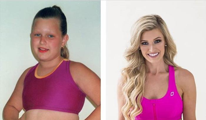 «Я была огромной по сравнению со всеми!»: над ней подшучивали по поводу веса, но будущей «Мисс Австралия» удалось похудеть на 25 кг