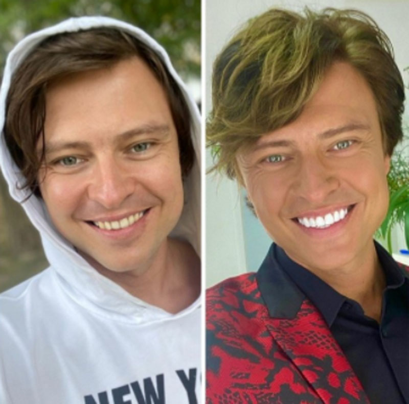 Шаляпин зубы до и после фото прохор