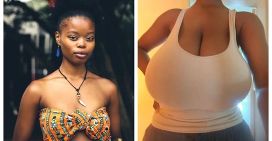  Как камень с души: жизнь девушки с 13 размером груди кардинально изменилась после операции по уменьшению бюста
