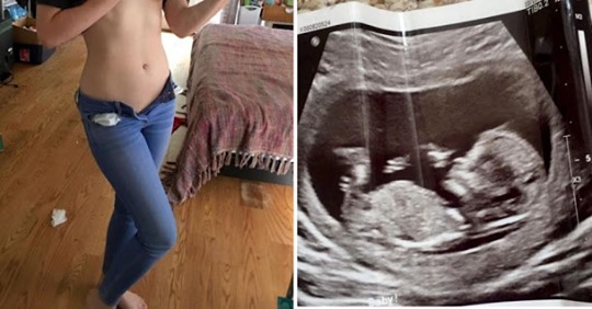 Девушку на шестом месяце беременности обвинили в обмане из за того, что у нее совсем нет живота
