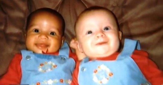 Сестры-близнецы с разным цветом кожи уже выросли и стали совсем взрослыми  