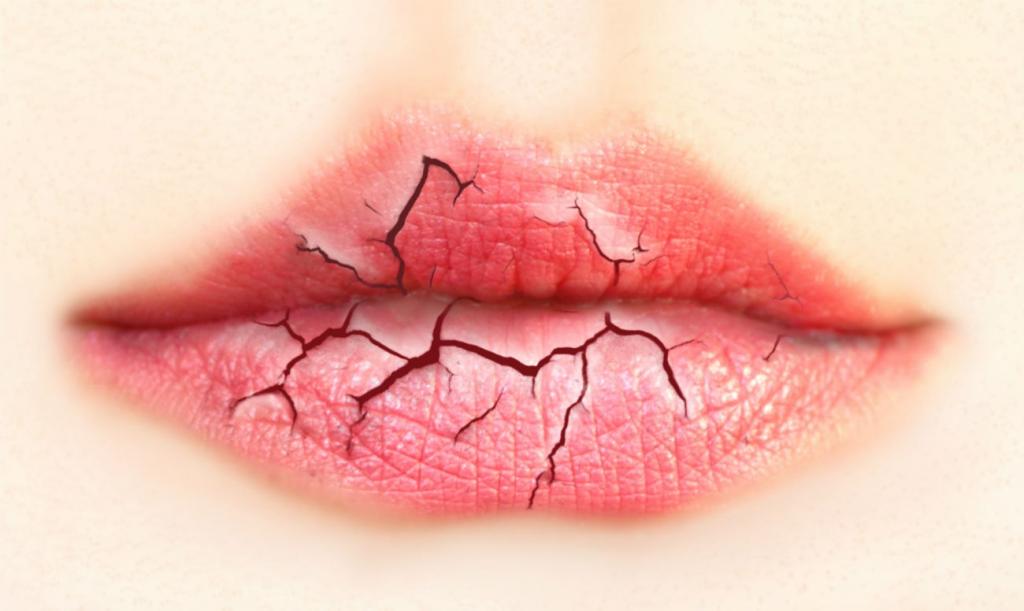 Шелушение, сухость, грубая кожа, потрескавшиеся губы и другие типичные зимние проблемы красоты: как это исправить (советы экспертов)