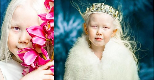 Девочка-альбинос, или Новая Белоснежка, покоряет модельные агентства мира