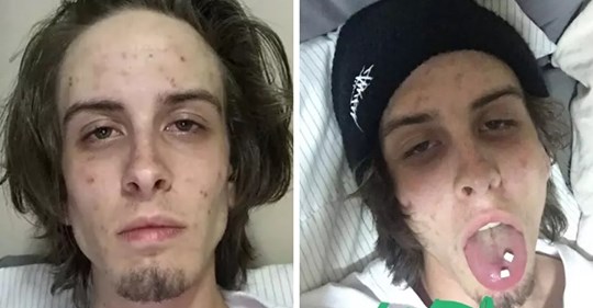 Бывший наркоман поделился фотографиями до и после лечения и показал, как его изменили 745 дней без наркотиков