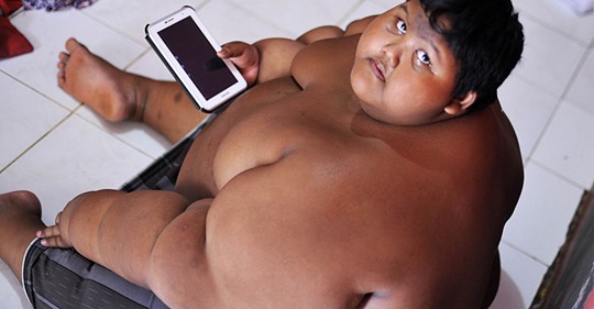Самый толстый в мире мальчик похудел до неузнаваемости: так он сейчас выглядит