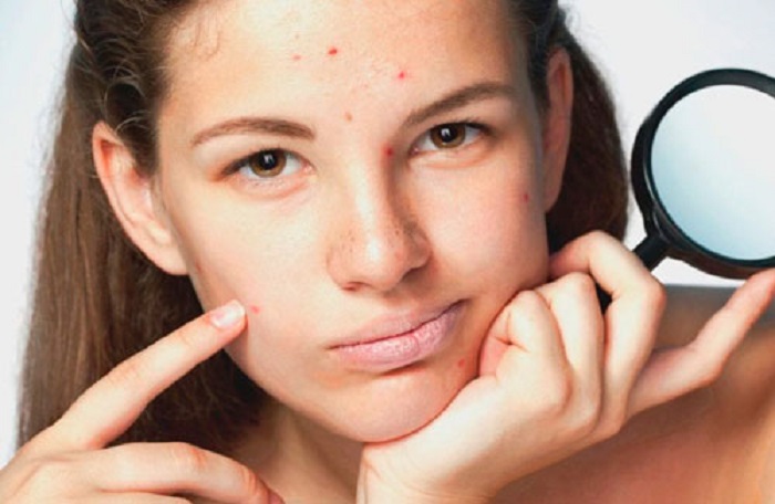 Детокс изнутри и снаружи и не только: как восстановить кожу лица после зимы