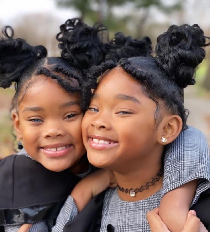 Темнокожим красавицам близняшкам с удивительными глазами уже по 9 лет. Как они выглядят сегодня